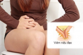 Bệnh viêm niệu đạo: Nguyên nhân và giải pháp điều trị kịp thời