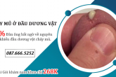 Dương vật chảy mủ: Dấu hiệu bệnh lý có nguy cơ vô sinh